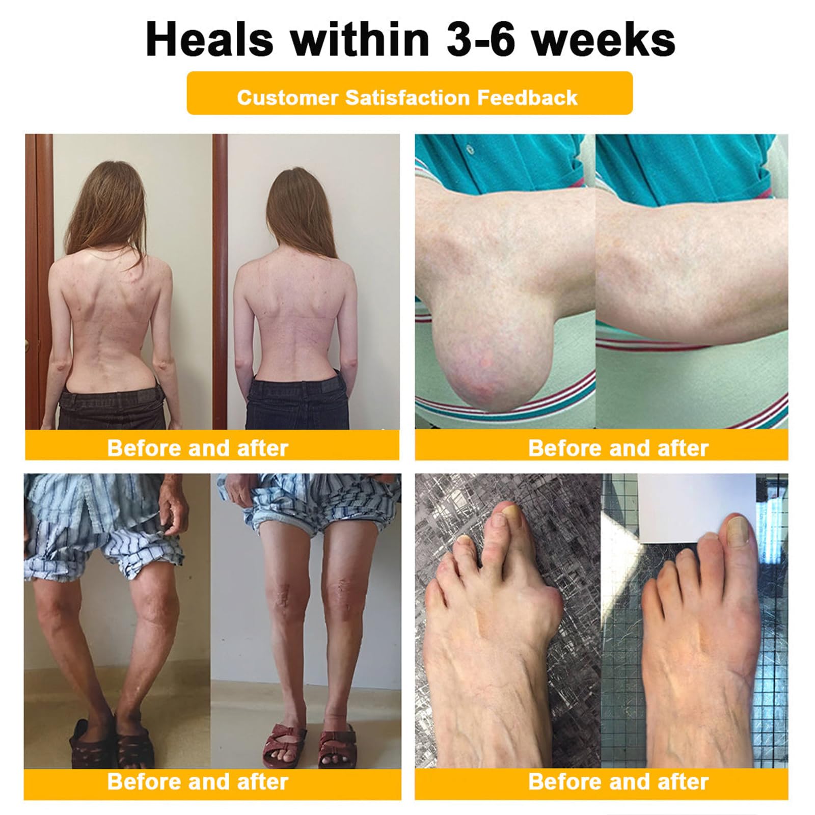 Luhaka Botulinum Toxin & Bee Venom Pain-Relief Bone Healing Cream,Bee Venom Cream,Effectively improve joint mobility (1PC) - TrustMedUSA