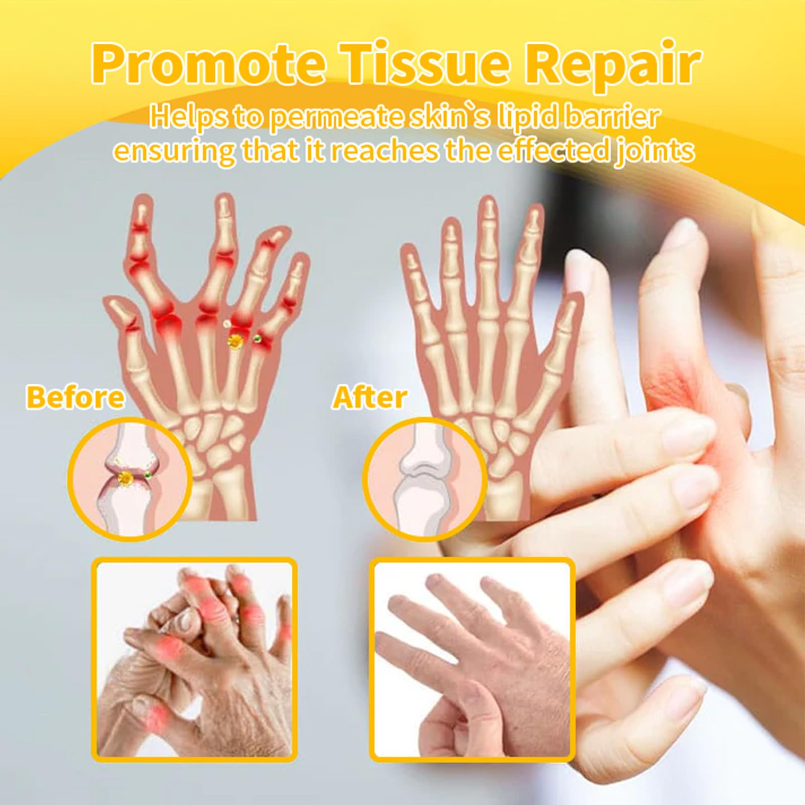 Luhaka Botulinum Toxin & Bee Venom Pain-Relief Bone Healing Cream,Bee Venom Cream,Effectively improve joint mobility (1PC) - TrustMedUSA