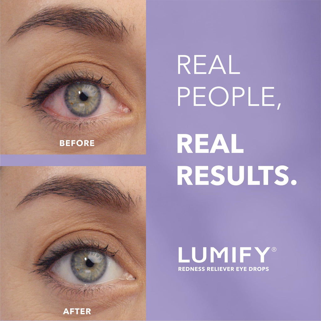 LUMIFY Eye Drops for Red Eyes, Redness Reliever for Brighter Looking Eyes, Works in 1 Minute & Lasts Up to 8 Hours, Eye Drops, 0.17 Fl Oz (5 mL) - TrustMedUSA