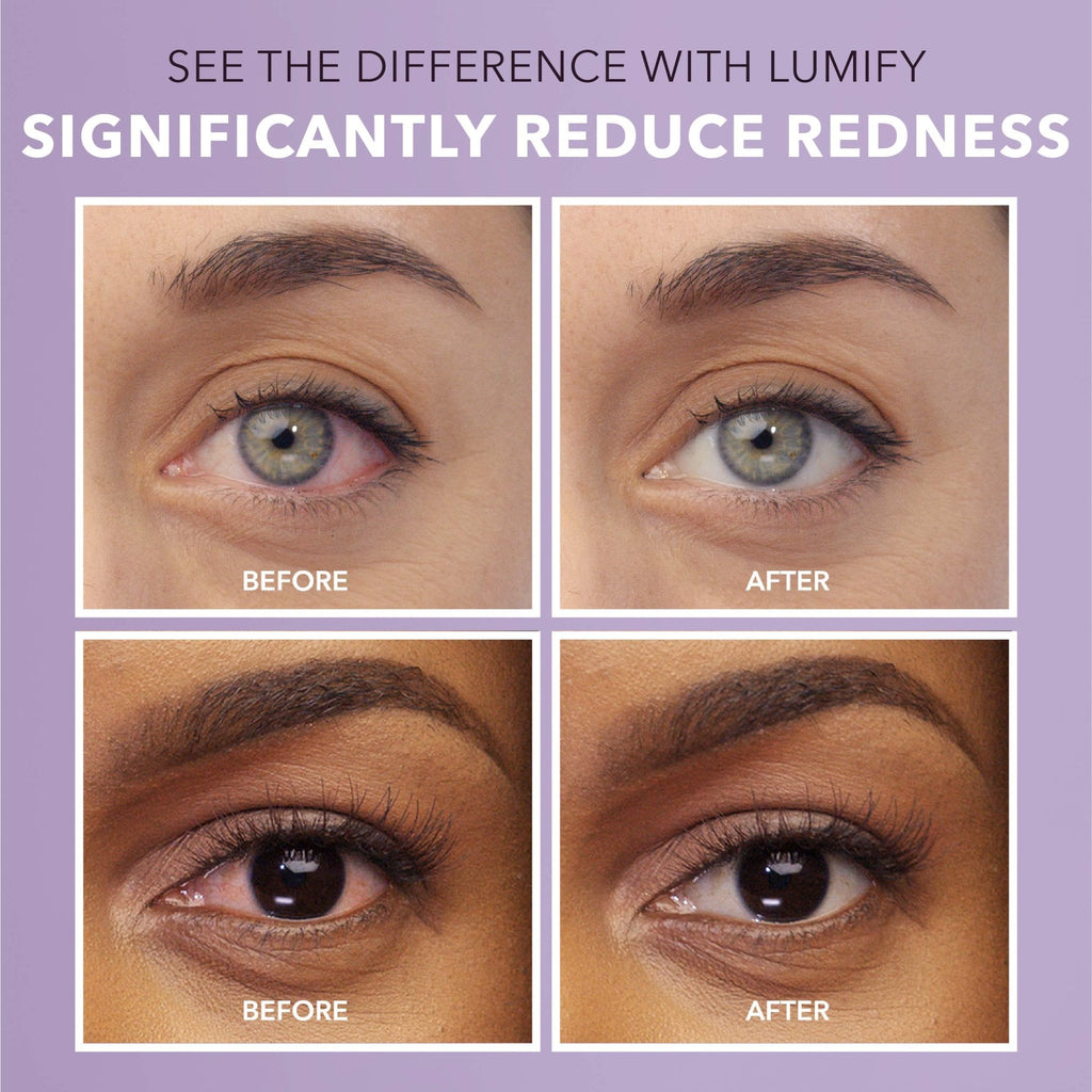 LUMIFY Eye Drops for Red Eyes, Redness Reliever for Brighter Looking Eyes, Works in 1 Minute & Lasts Up to 8 Hours, Eye Drops, 0.25 Fl Oz (7.5mL) - TrustMedUSA