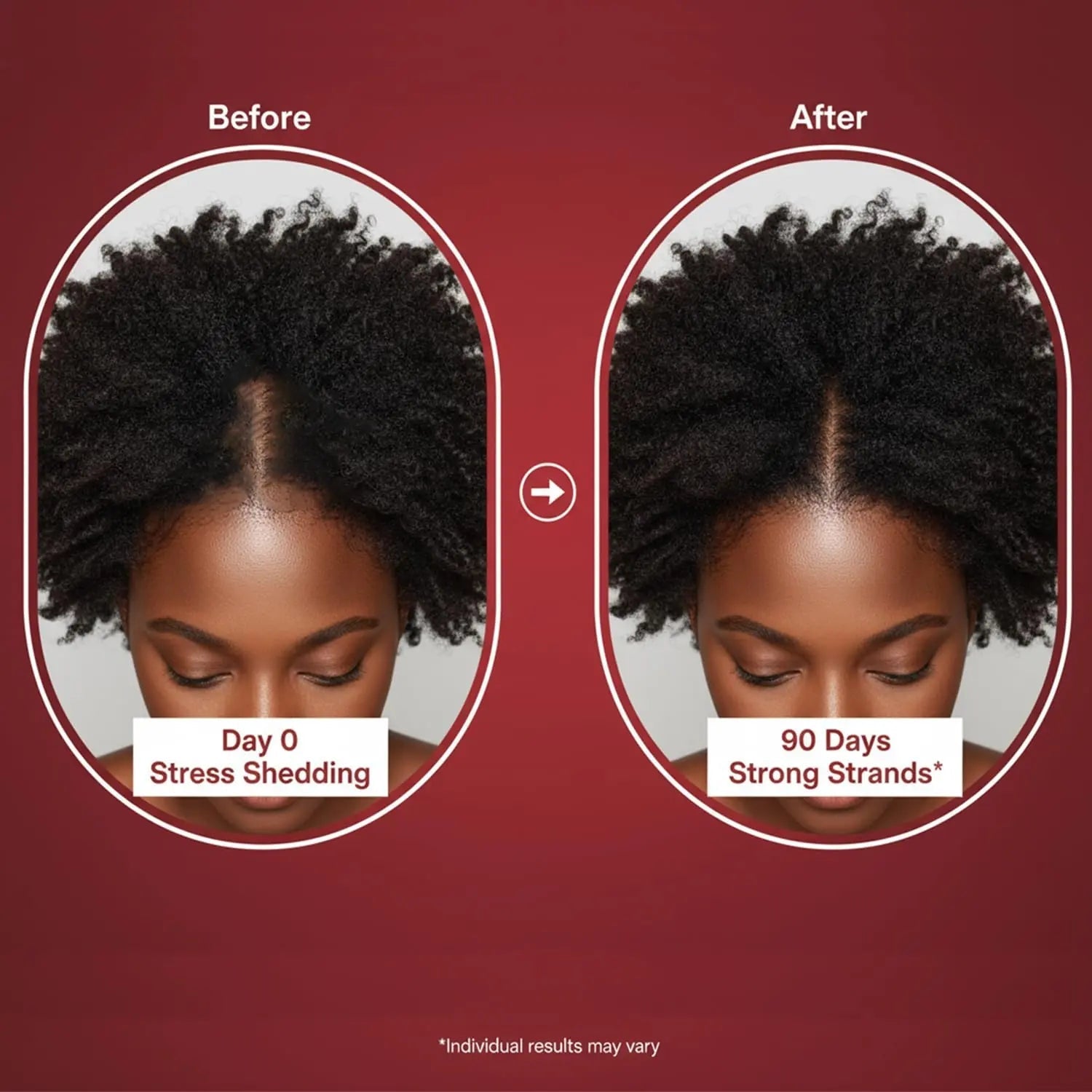Lumin Hair Growth Gummies for Black Women, 60 Vegan Gummies, Daily Hair Nourishment with Biotin, Collagen & Botanical Extracts, Supports Healthy Hair Growth & Strength - TrustMedUSA