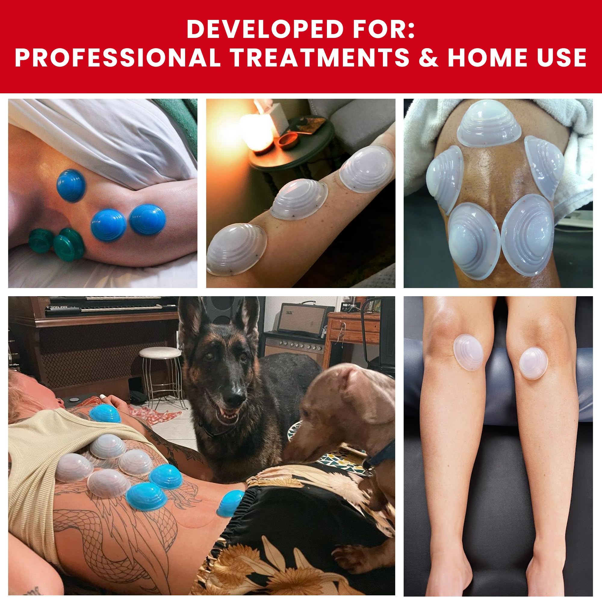 Lure Essentials Cupping Therapy Set 10 Professional Silicone Cupping Cups for Muscle Knots, Joints, Muscles, Arms and Feet - TrustMedUSA