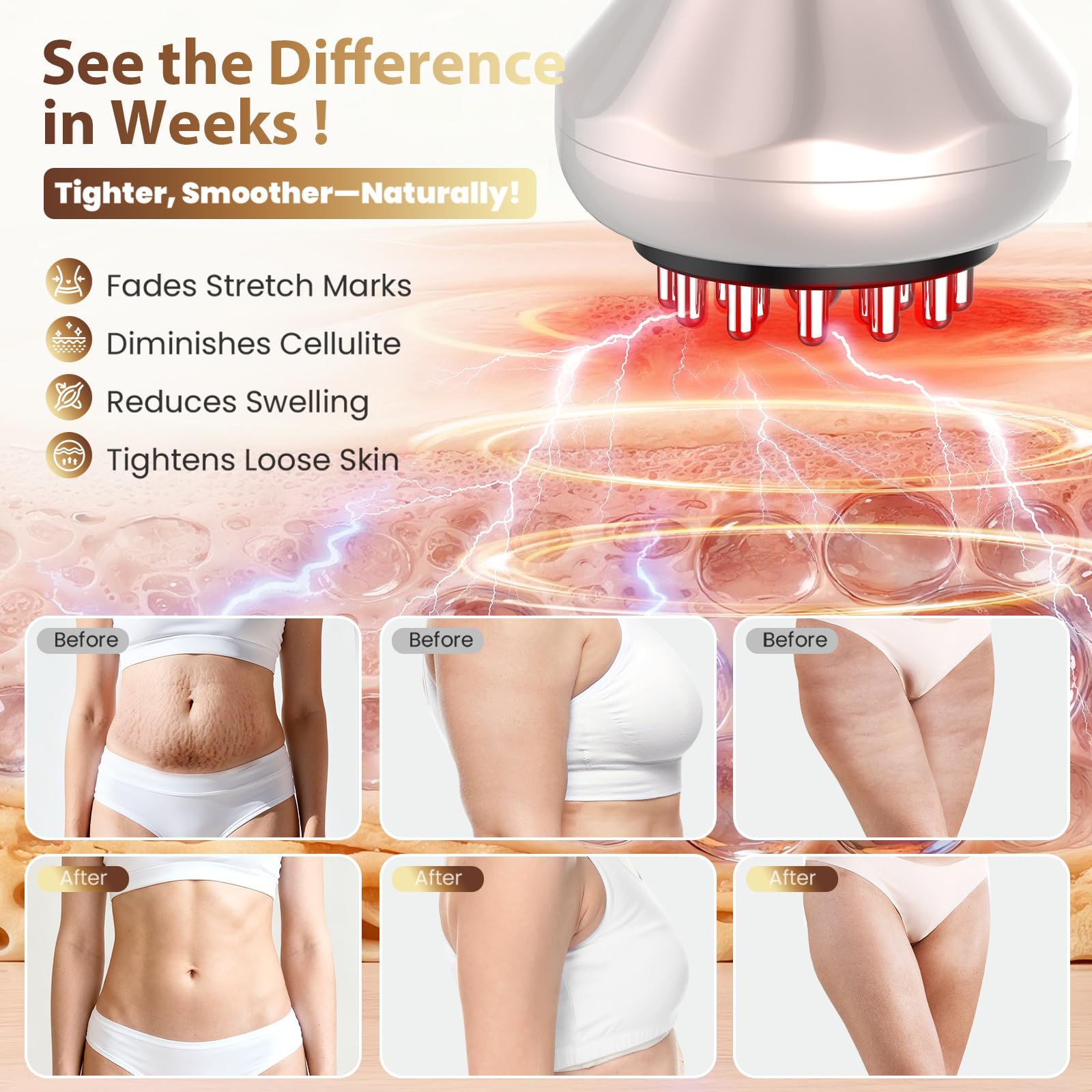 Lymphatic Drainage Massager, Anti Cellulite Massage Tool For Belly & Thigh Stretch Marks & Cellulite Reduction, Handheld Massage tools for Sciatica Nerve, shoulder, Hip, Muscle, Low Back Pain Relief - Maple Wellness Supplements
