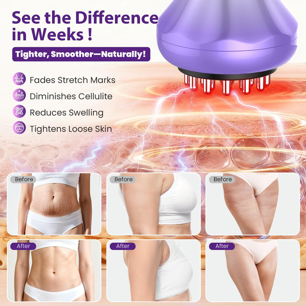 Lymphatic Drainage Massager, Anti Cellulite Massage Tool For Thigh & Belly Stretch Marks & Cellulite Reduction, Handheld Massage tools for Sciatica Nerve, Legs, Arms, Hip, Muscle, Low Back Pain Relief - Maple Wellness Supplements