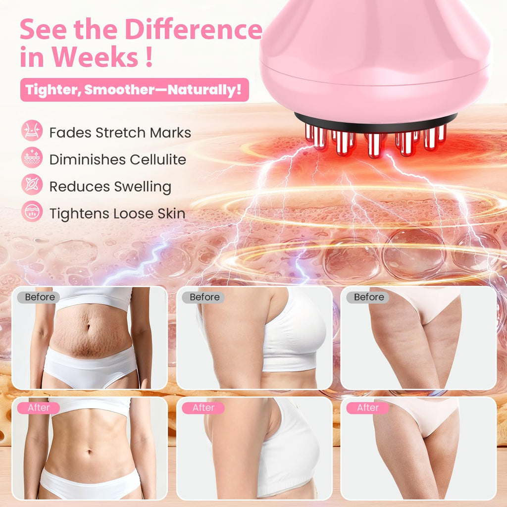 Lymphatic Drainage Massager, Anti Cellulite Massage Tool For Thigh & Belly Stretch Marks & Cellulite Reduction, Handheld Massage tools for Sciatica Nerve, Legs, Arms, Hip, Muscle, Low Back Pain Relief - Maple Wellness Supplements