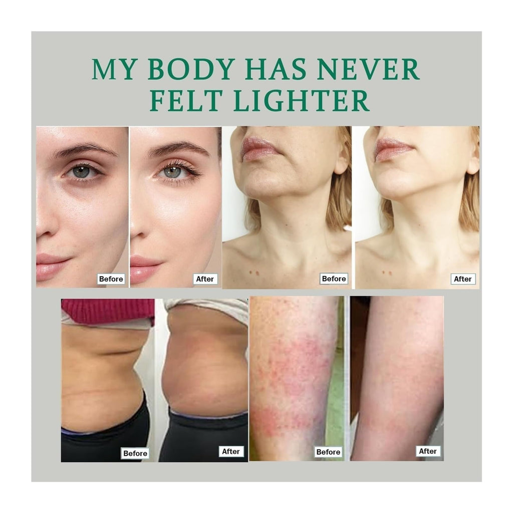 Lymphatic Drainage Natural Herbal Blend - Maple Wellness Supplements