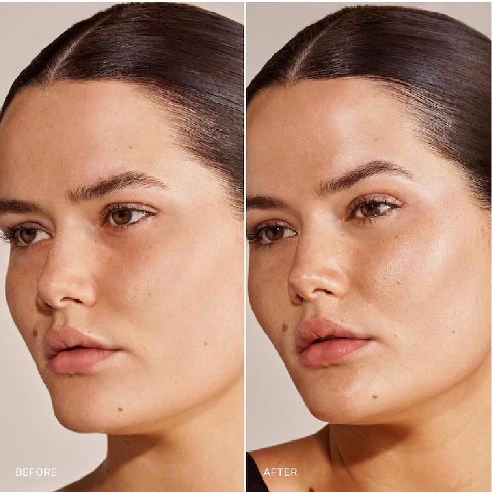 M Great Skin Instant Glow Serum with Niacinamide and Hyaluronic Acid (1.69 oz / 50 ml) + Bonus Acne Patch (36 Pieces) Tea Tree Oil Facial Water Gel - TrustMedUSA