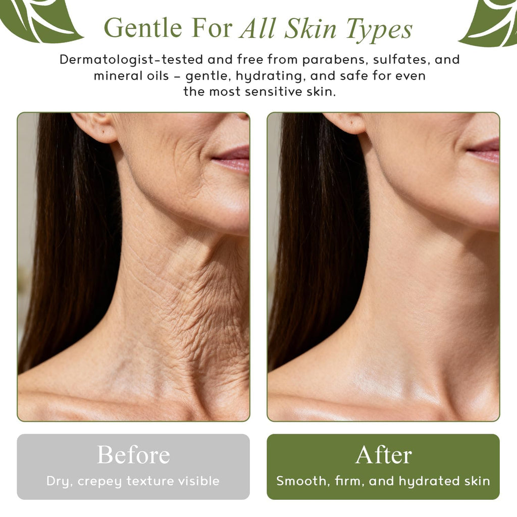 M.D. Blend Crepe-Ease Body Moisturizer Anti Aging Retinol Cream Firming, Smoothing & Hydrating Cream for Crepey Skin on Neck, Arms & Legs Crepe Skin Repair, Advanced Crepe Fix, 4 oz - Maple Wellness Supplements
