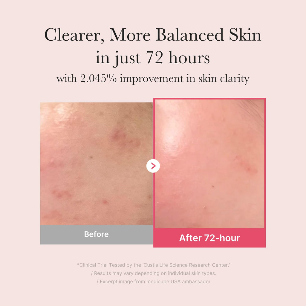 medicube TXA+Niacinamide 15% Glow Facial Serum for After Spot Care | All-in-One Daily - TrustMedUSA