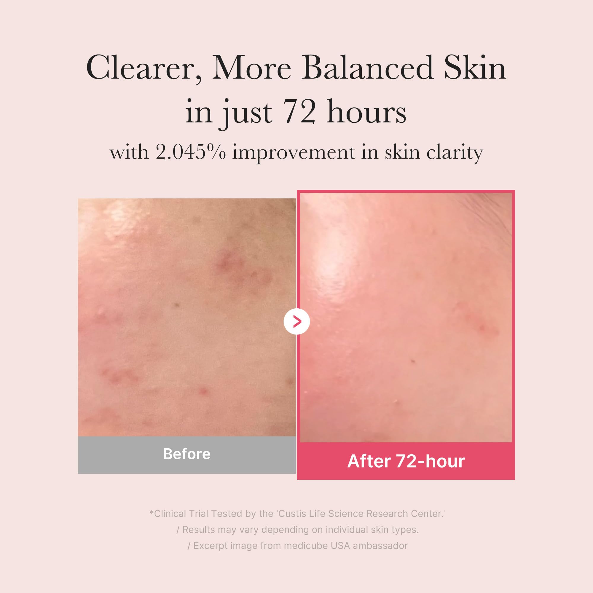 medicube TXA+Niacinamide 15% Glow Facial Serum for After Spot Care | All-in-One Daily - TrustMedUSA