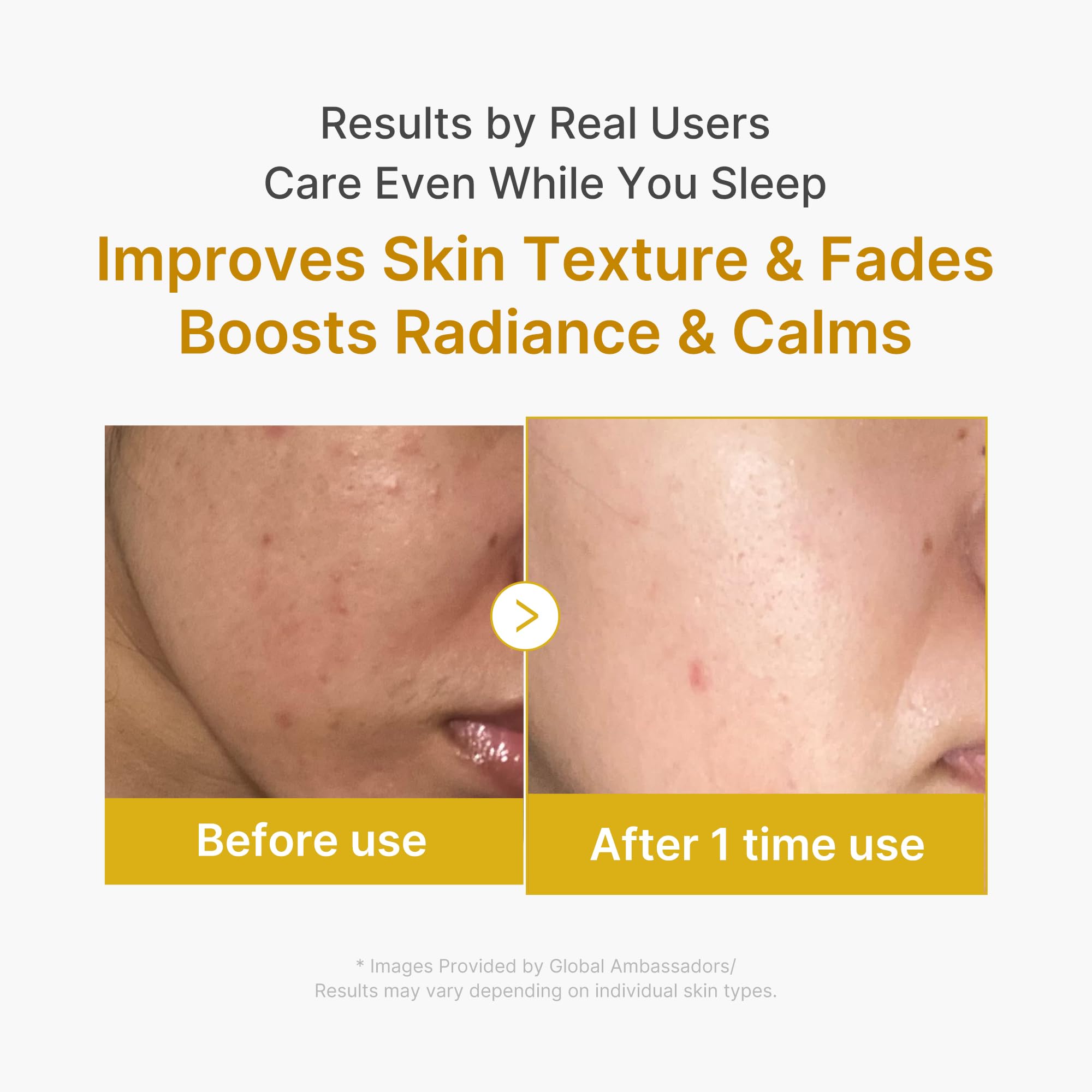 medicube Wrapping Mask Kojic Acid, Turmeric, Vitamin C Overnight Peel Off Facial Mask | Brighten & Defends Against Skin Stress for a Clear, Glowing Complexion | Korean Skin Care, 2.53 fl.oz - Maple Wellness Supplements