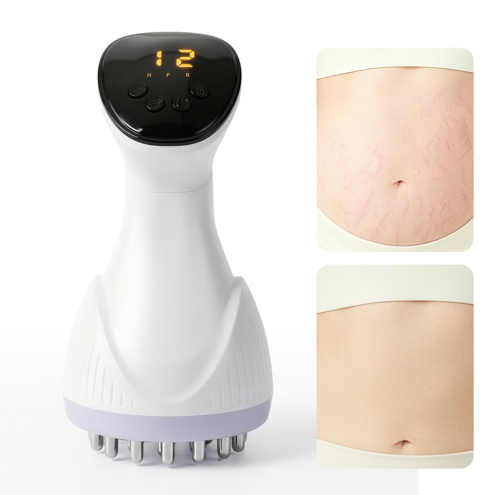 MMGJMP Lymphatic Drainage Massager & Anti-Cellulite Massage Tool, Body Contouring Device for Legs, Arms & Stomach, Supports Smoother Skin, with Gentle Warming & Vibration - W - Maple Wellness Supplements