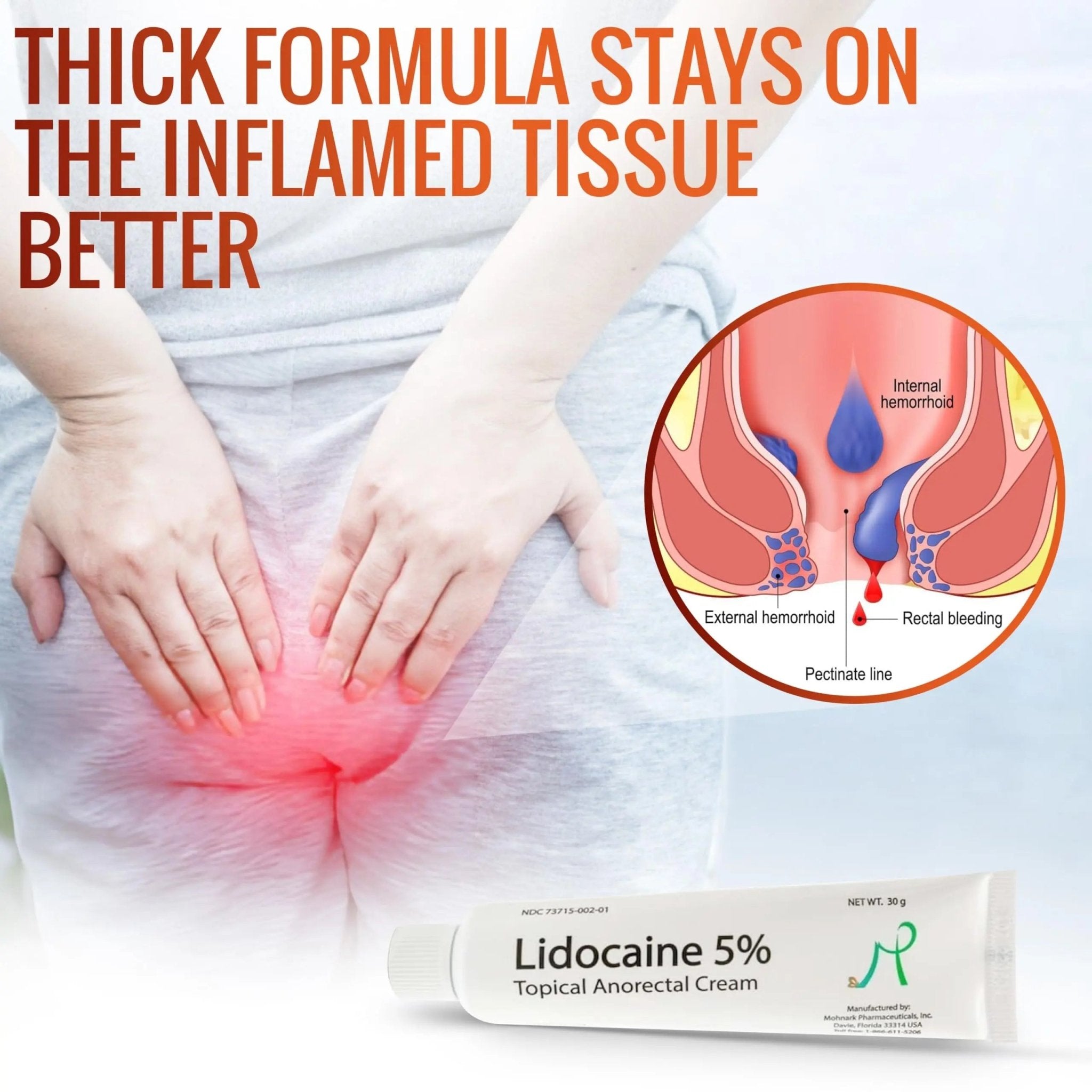Mohnark Maximum Strength Lidocaine Hemorrhoid Treatment Cream for External and Internal Hemorrhoids Treatment Burn Itch Pain Relief Anal Cream Topical Anorectal Numbing Cream- 30 Gram Tube Made in USA - TrustMedUSA