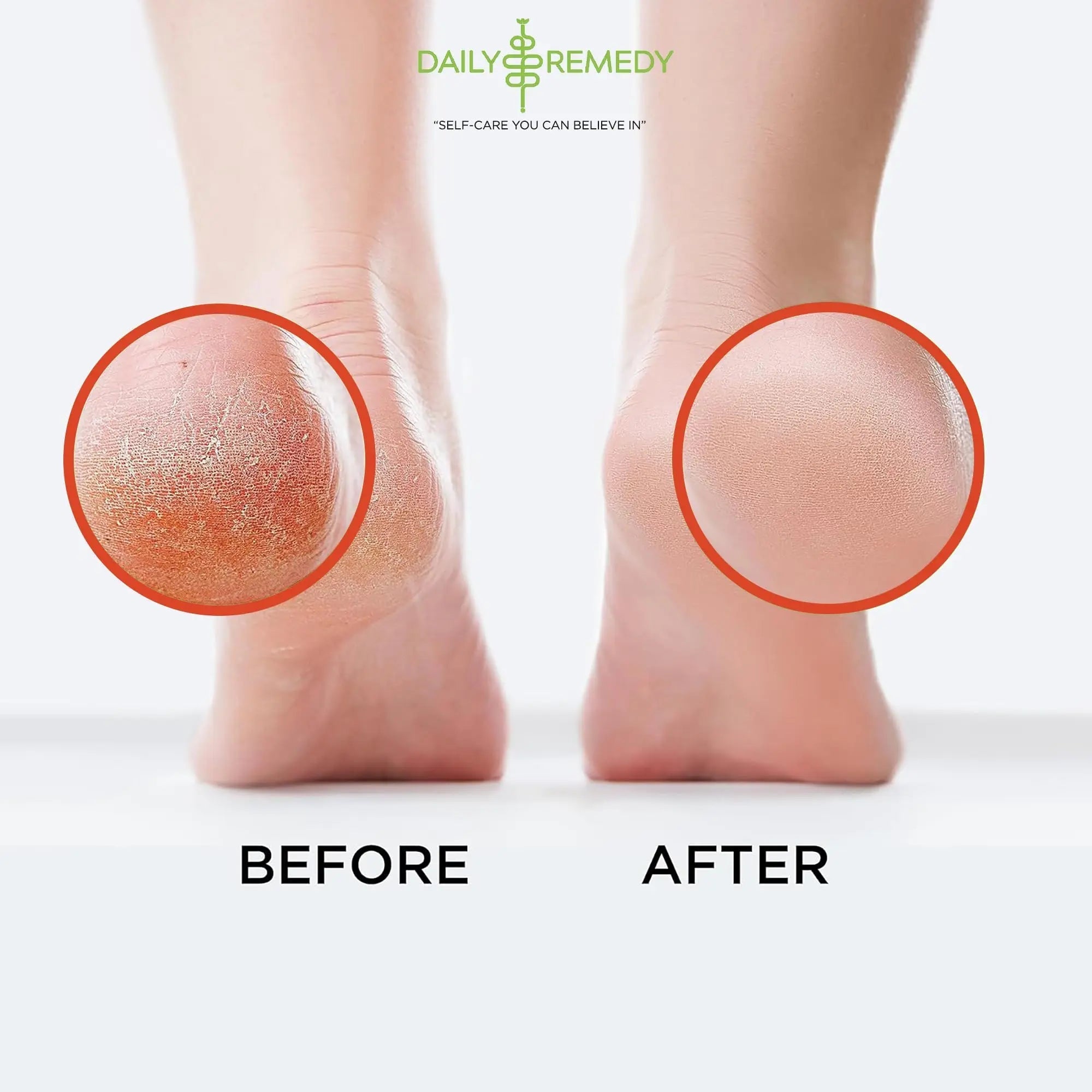Muscle Relief Foot Soak with Epsom Salt, Made in USA, Soothe Foot Aches, Muscle Pain - TrustMedUSA