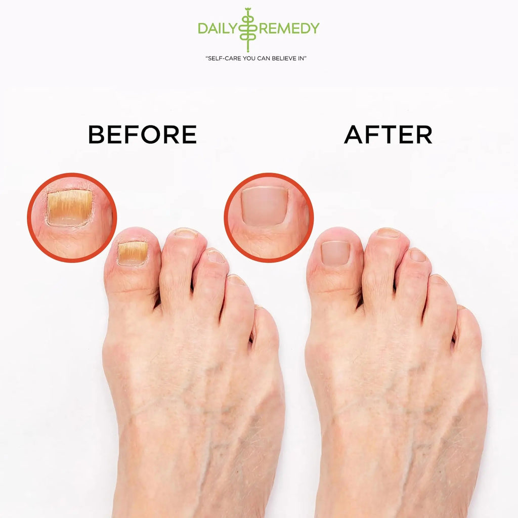 Muscle Relief Foot Soak with Epsom Salt, Made in USA, Soothe Foot Aches, Muscle Pain - TrustMedUSA