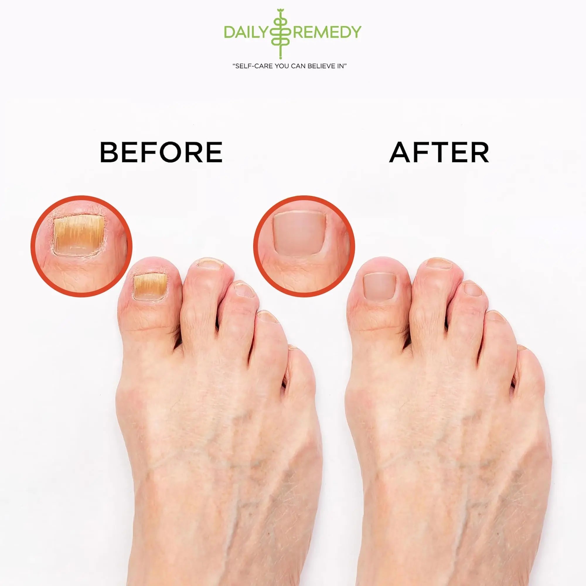 Muscle Relief Foot Soak with Epsom Salt, Made in USA, Soothe Foot Aches, Muscle Pain - TrustMedUSA