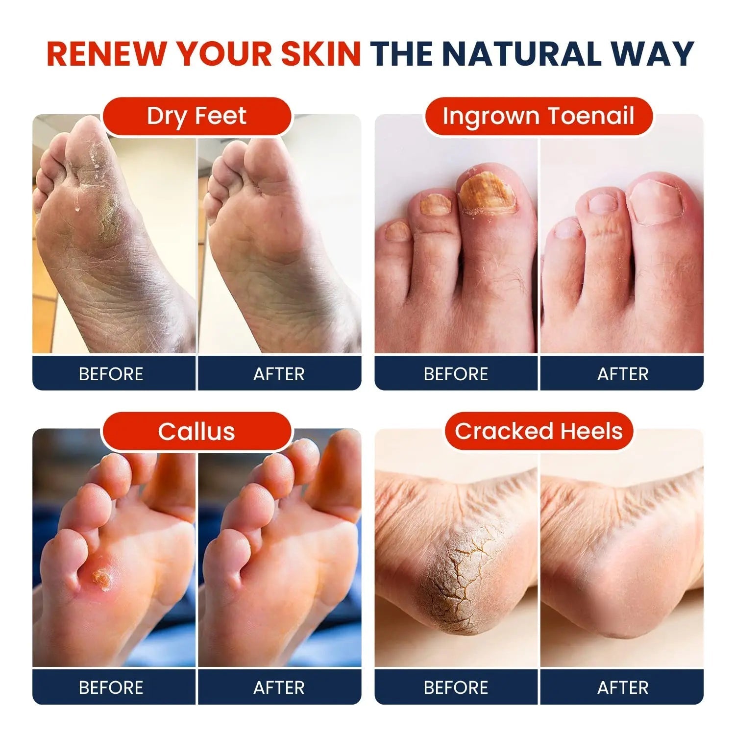Muscle Relief Foot Soak with Epsom Salts - All Natural Salts for Post Workout Recovery - TrustMedUSA
