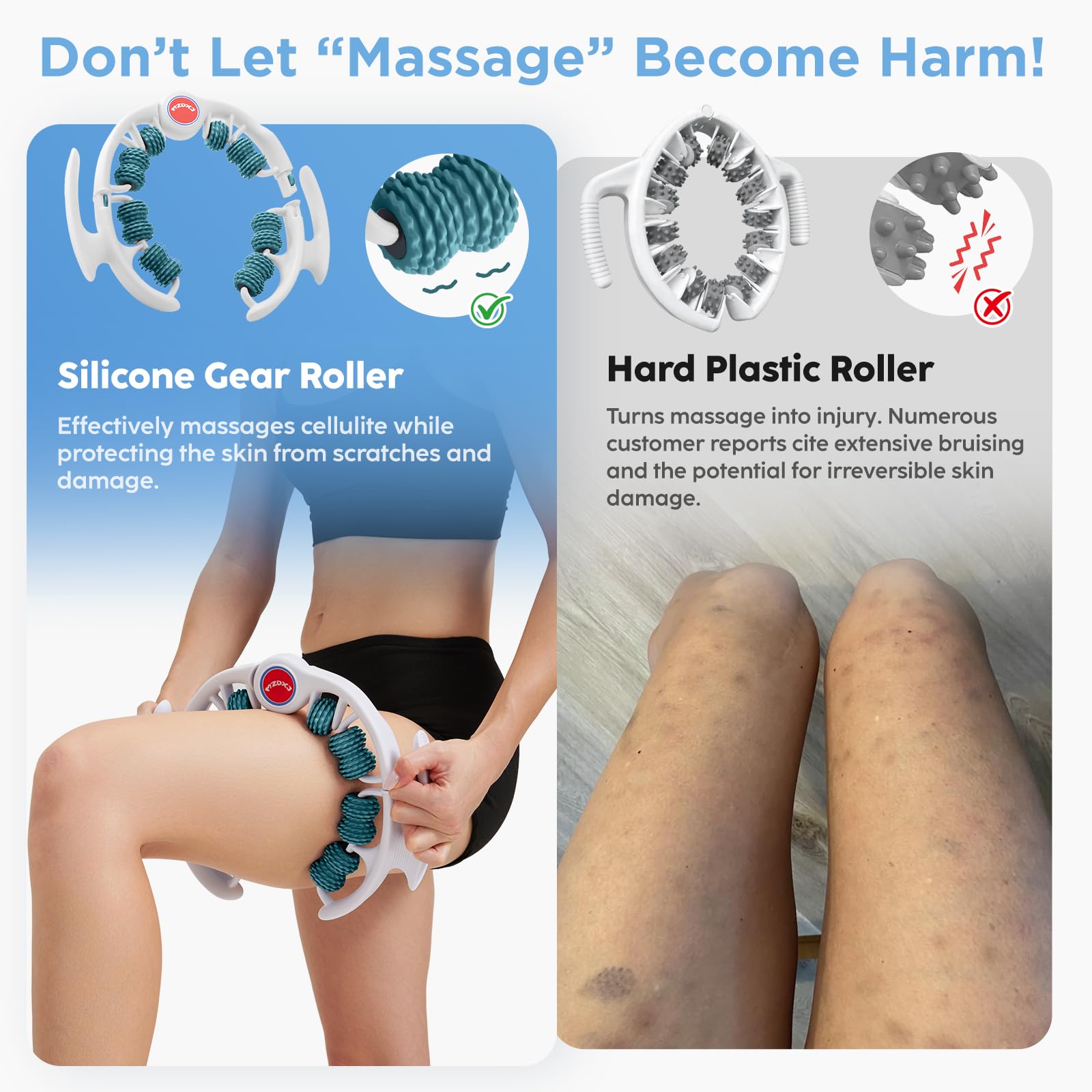 MZDXJ Cellulite Massage Tool - Lymphatic Drainage Massager - Muscle Roller, Deep Fascia Massage, Dimpled Skin Removal, Legs/Thighs/Buttocks, Anti-Cellulite Roller, Smooth Skin (14 Wheel - Green) - Maple Wellness Supplements