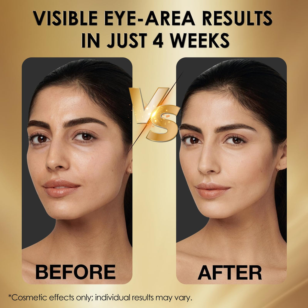 NIAWIT Eye Serum – Anti-Fatigue Eye Care for Dark Circles, Puffiness & Fine Lines with Niacinamide, Peptides & Caffeine – Gentle Clean Beautiful for Daily Use Around the Delicate Eye Area - Maple Wellness Supplements