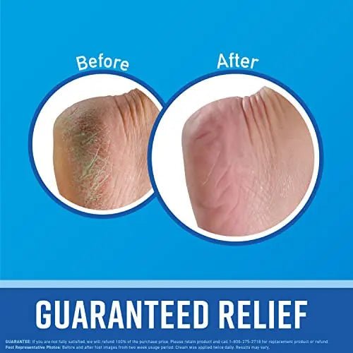 O'Keeffe's for Healthy Feet Foot Cream, Guaranteed Relief for Extremely Dry, Cracked Feet - TrustMedUSA