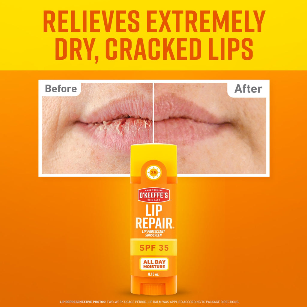 O'Keeffe's Lip Repair SPF 35 Lip Balm - Stick (3 Pack) - Sun-Safe Moisturizer for Extremely Cracked, Dry Lips - TrustMedUSA