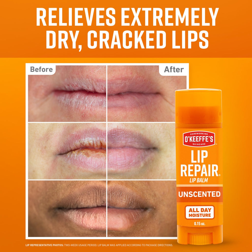 O'Keeffe's Lip Repair Unscented Lip Balm for Dry, Cracked Lips - Stick (3 Pack) - Moisturizer for Very Dry Lips - TrustMedUSA