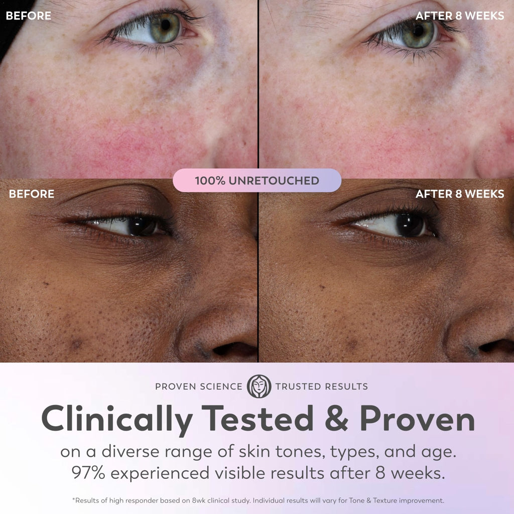 Olay Super Serum - Glow Serum for Face - Activated Niacinamide, Vitamin C & E, Collagen Peptide, AHA - 5-in-1 Benefits - Brightens, Hydrates, Smooths, Firms, Evens Tone, Proactive Anti-Aging, 1.7 Oz - TrustMedUSA