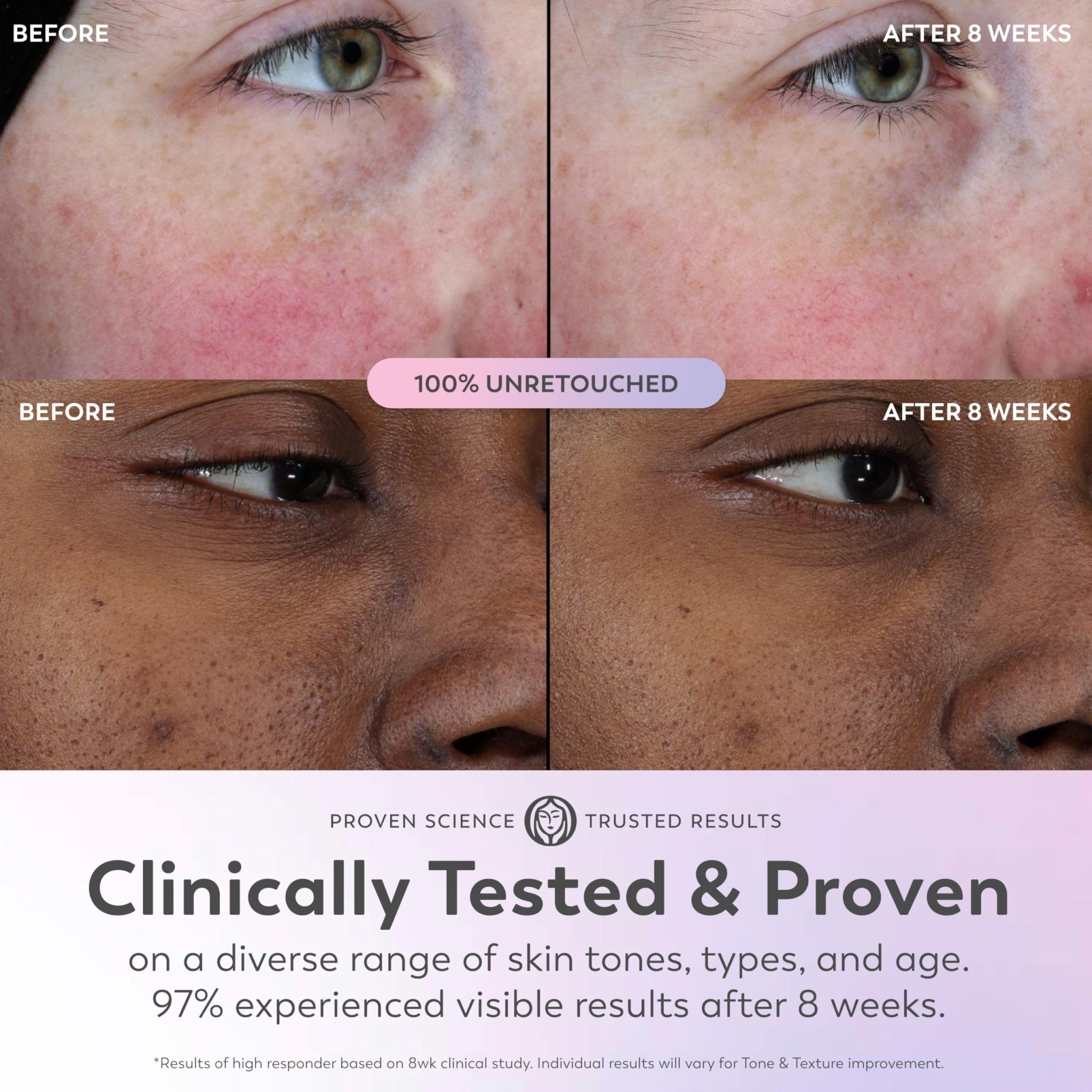 Olay Super Serum - Glow Serum for Face - Activated Niacinamide, Vitamin C & E, Collagen Peptide, AHA - 5-in-1 Benefits - Brightens, Hydrates, Smooths, Firms, Evens Tone, Proactive Anti-Aging, 1.7 Oz - TrustMedUSA