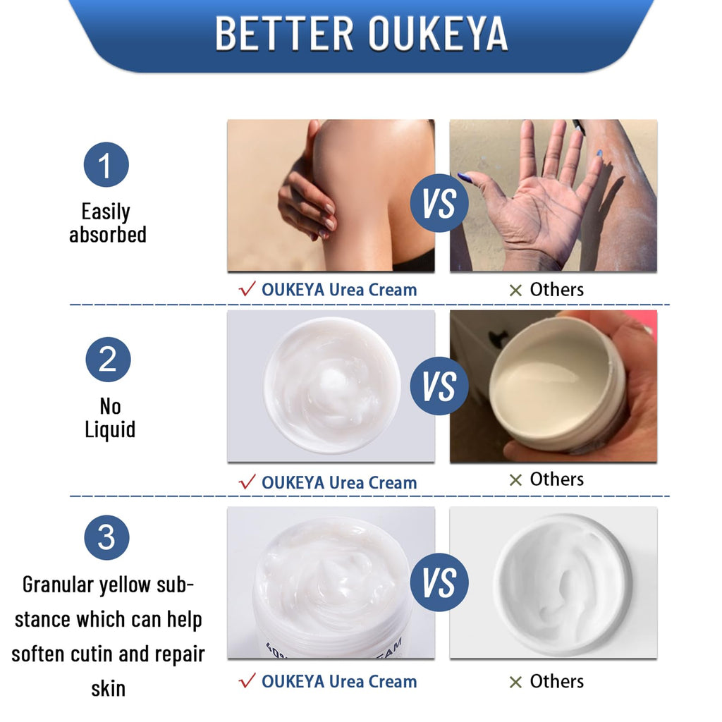 OUKEYA Urea Cream 40 Percent,Foot & Hand Cream for Dry Cracked,Urea Lotion for Feet Maximum Strength - Maple Wellness Supplements
