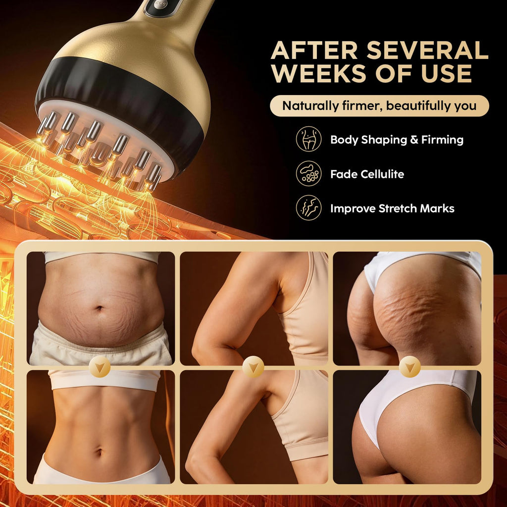 OVGIAP Lymphatic Drainage Massager & Anti-Cellulite Massage Tool, Body Sculpting Device for Legs, Arms & Stomach, Supports Smoother Skin, with Gentle Warming & Vibration - Gold - Maple Wellness Supplements
