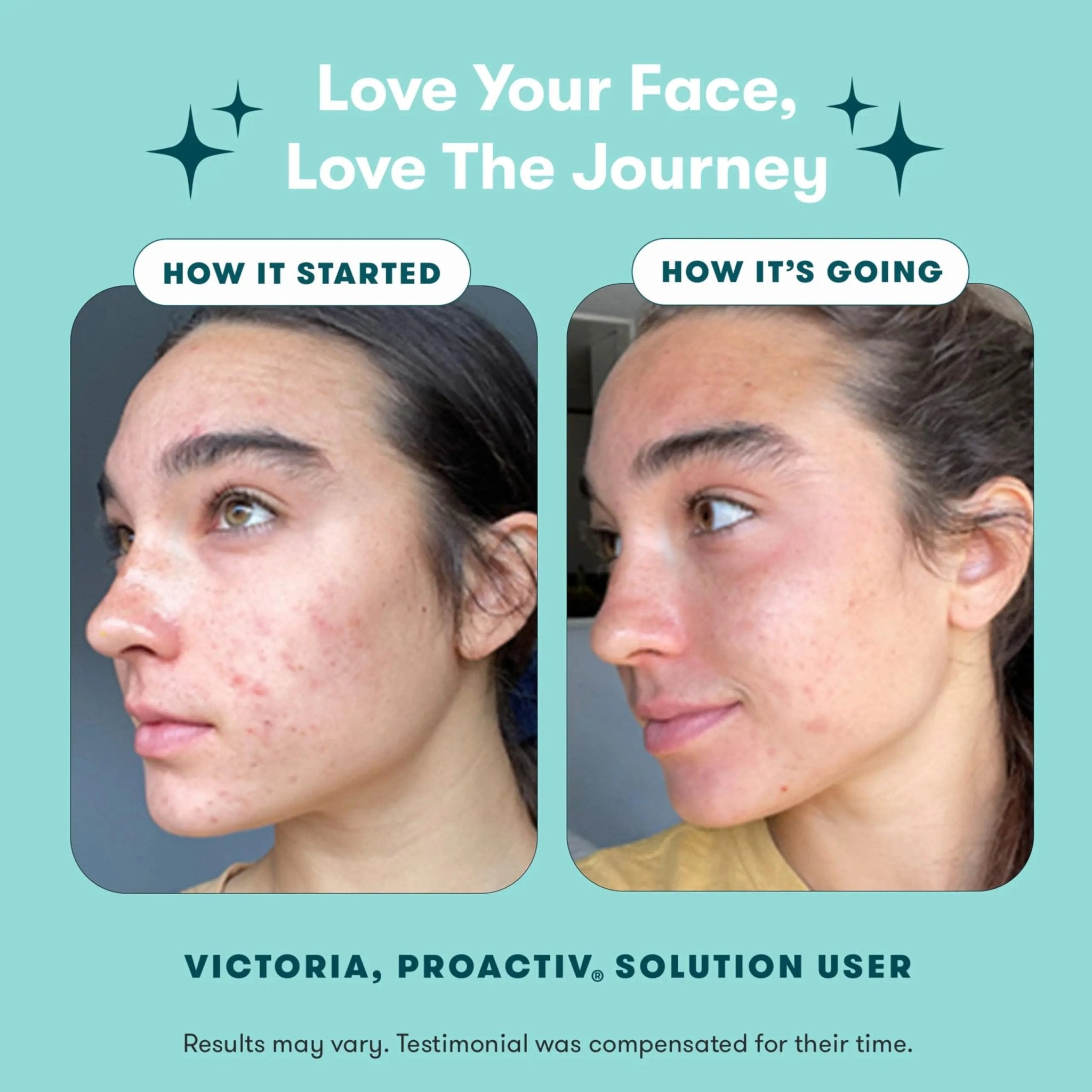 Proactiv 3 Step Acne Treatment - Benzoyl Peroxide Face Wash, Repairing Acne Spot Treatment for Face and Body - TrustMedUSA