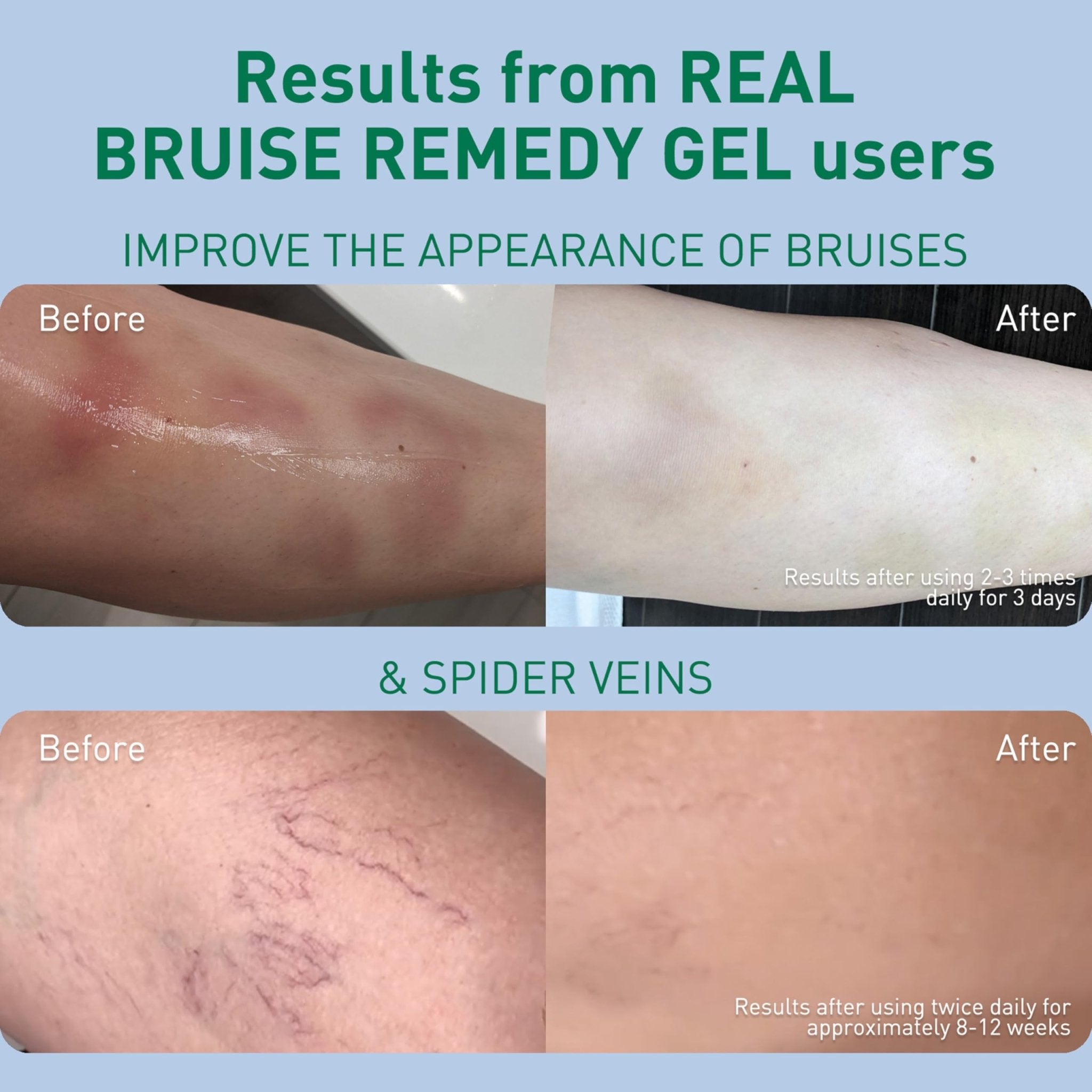 PROcure Arnica & MSM Bruise Remedy Gel – Paraben-Free, Unscented Arnica Montana Gel for Bruising, Spider Veins & Skin Discoloration – 2 Pack - TrustMedUSA