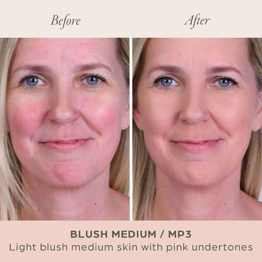 PUR Beauty 4-in-1 Pressed Mineral Makeup Powder Foundation with SPF 15 - Concealer & Finishing Compact Pressed Powder for Face - Buildable Medium to Full Coverage Foundation Powder (Blush Medium) - TrustMedUSA