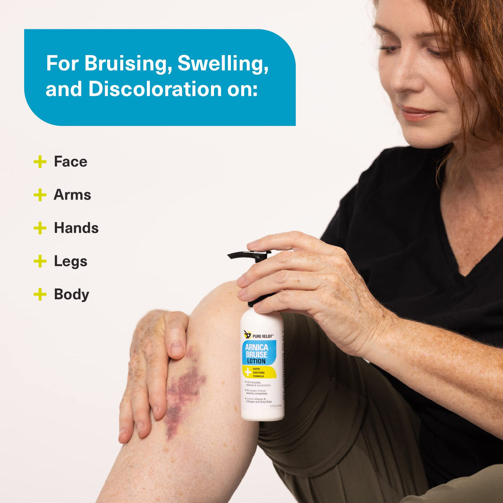 Pure Relief Arnica Bruise Relief Lotion for Bruising, Swelling, & Discoloration On Skin, Natural Skin Care Arnica Bruise Homeopathic Topical Bruise Cream W/Aloe Vera & Collagen, 4 Fl Oz (Pack of 3) - TrustMedUSA