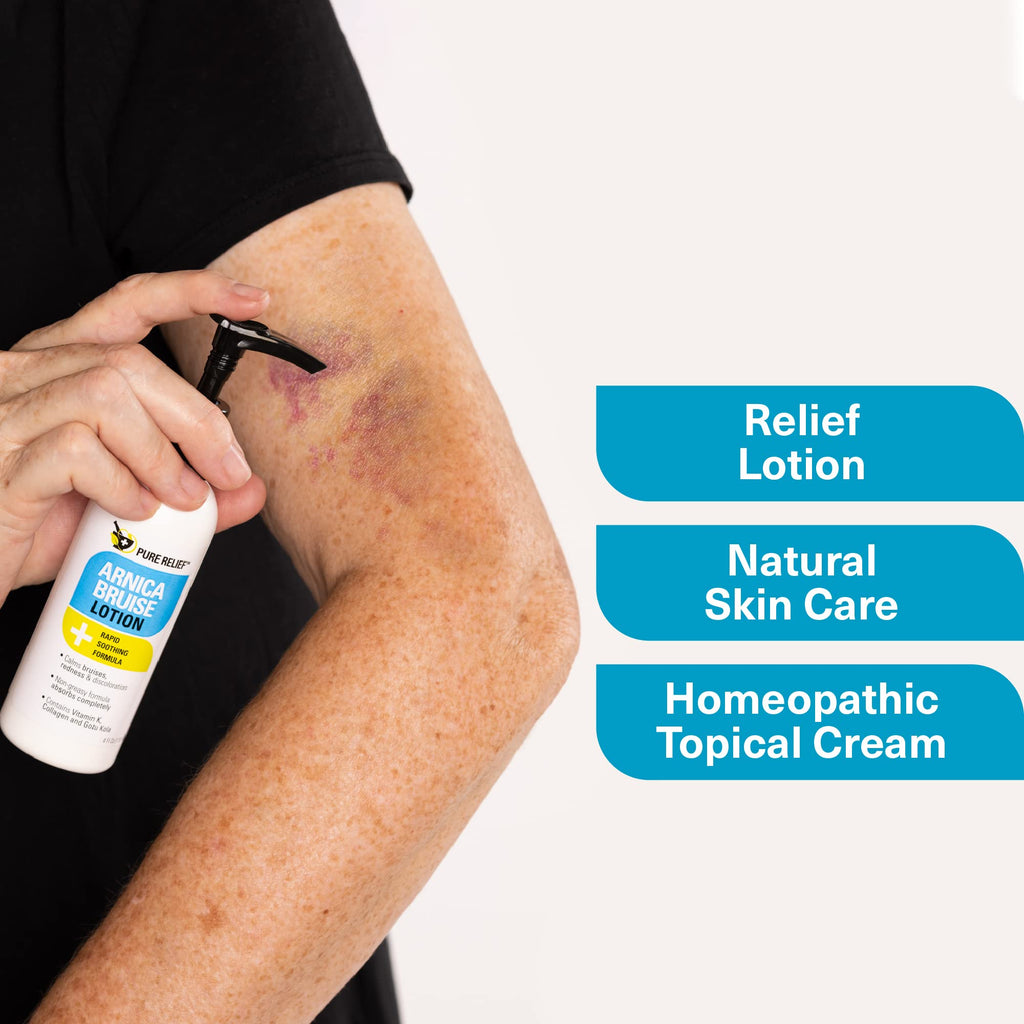 Pure Relief Arnica Bruise Relief Lotion for Bruising, Swelling, & Discoloration On Skin, Natural Skin Care Arnica Bruise Homeopathic Topical Bruise Cream W/Aloe Vera & Collagen, 4 Fl Oz (Pack of 3) - TrustMedUSA