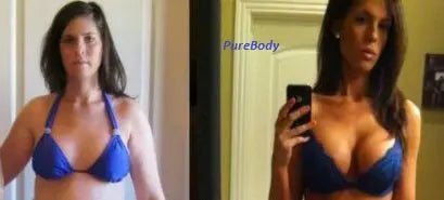 PureBody Cream | Butt and Breast Cream - The 1 and Only Butt and Breast Growth - TrustMedUSA