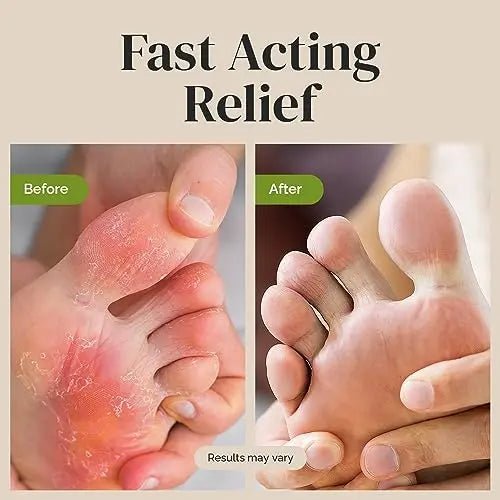 Puriya Tea Tree Oil Antifungal Cream, Plant-Powered Athletes Foot Cream Treatment - TrustMedUSA