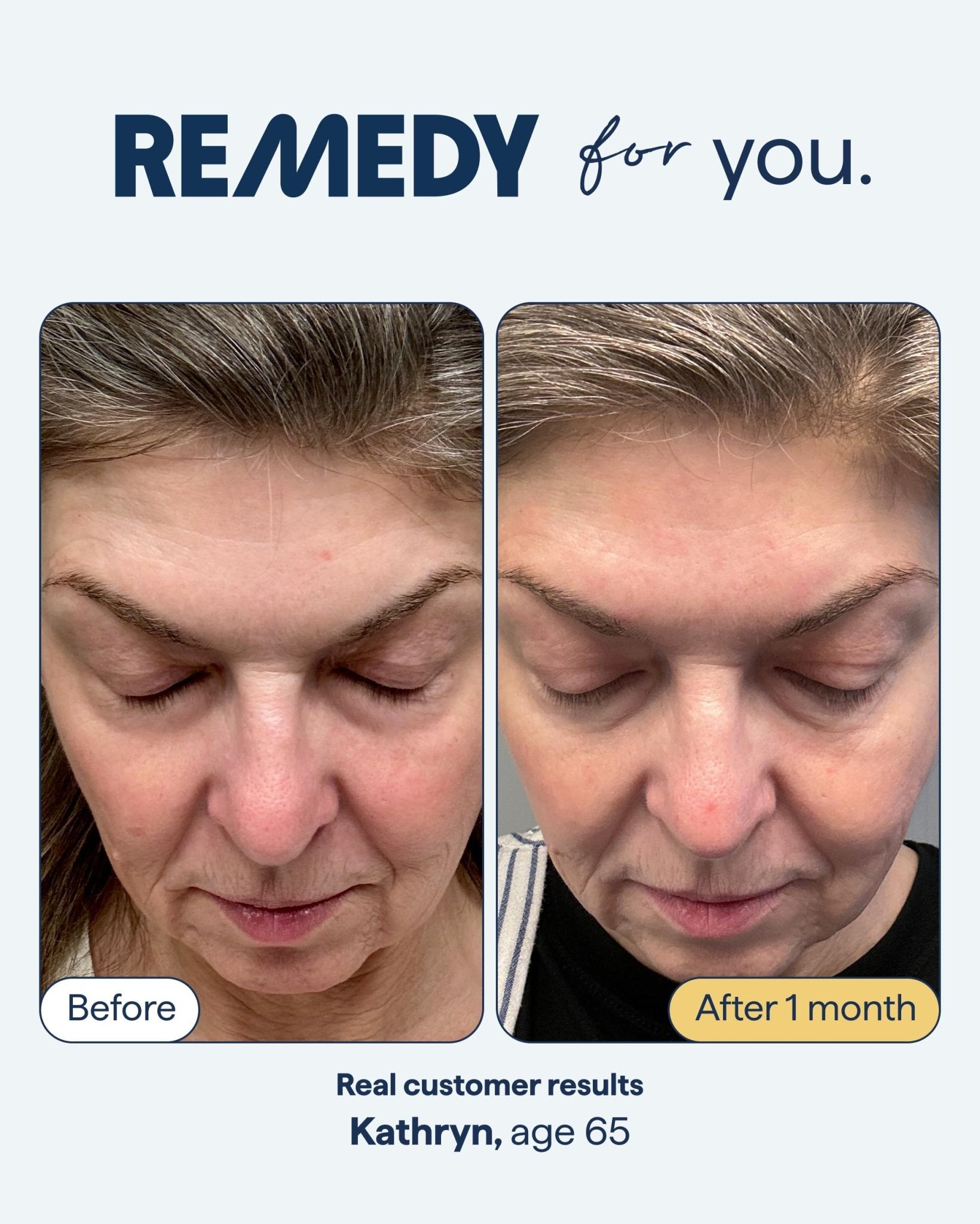 Remedy for Healthy Aging - Retinal, Resveratrol, Glycolic Acid, Argireline, Ferulic Acid, Matrixyl 3000 - Anti-Aging Treatment for Wrinkles, Uneven Texture & Tone - By Dermatologist Dr. Shah - TrustMedUSA