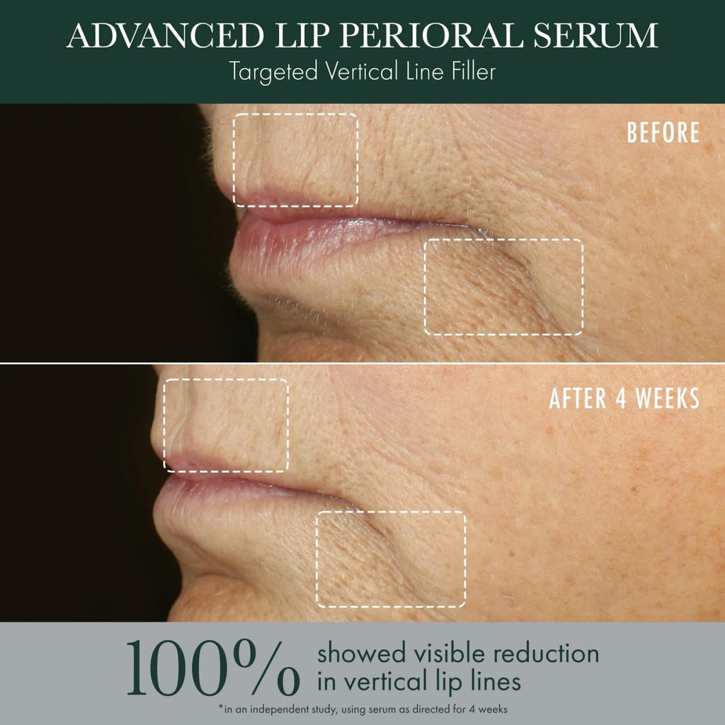 RéVive Advanced Perioral Lip Serum - Anti Aging Perioral Lip Treatment to Reduce Lip Area Lines & Wrinkles -Helps Restore Lip Contour & Visible Fullness(0.5 fl oz) - TrustMedUSA
