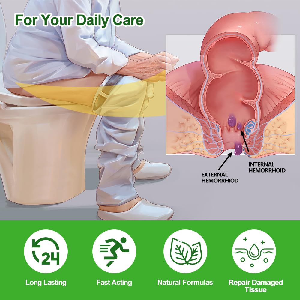 RHAICARE Hemorrhoid and Fissure Treatment Cream,Hemorrhoidal Ointment for Fast Acting Itch, Swelling, and Maximum Strength Pain Relief - TrustMedUSA