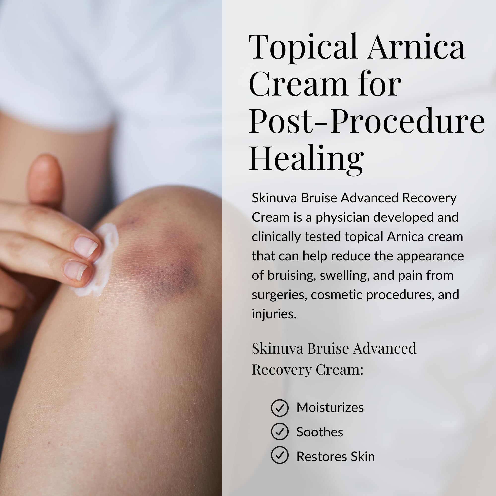 Skinuva® Bruise Advanced Recovery Cream - Topical Bruise Cream Formulated with Growth Factors, Arnica & Vitamin K (1 oz) - TrustMedUSA