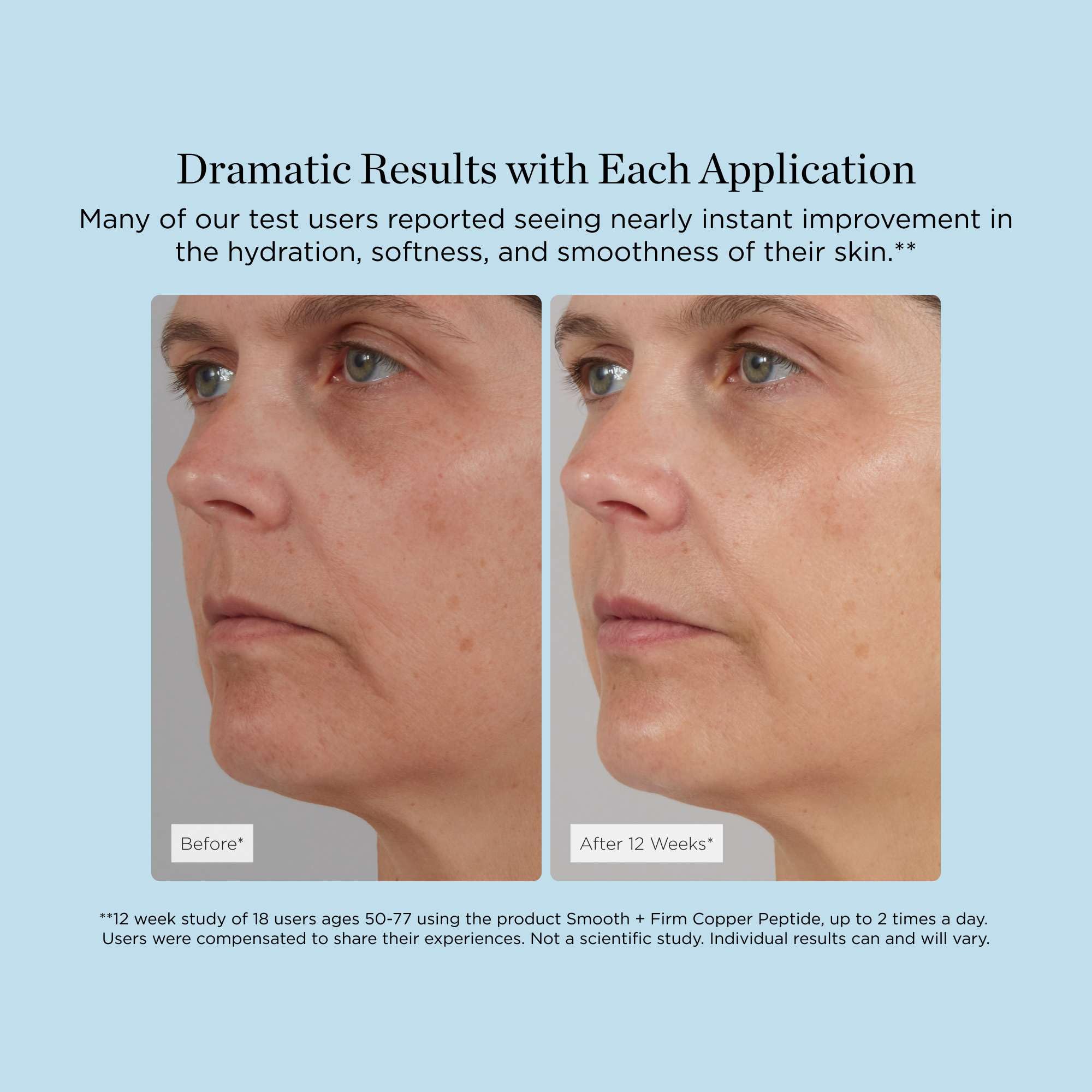 Smooth + Firm Copper Peptide Concentrate Serum for Aging Skin, Plumping Niacinamide for Tightening & Brightening, Helps Improve Elasticity, Hyperpigmentation & Dark Spots, Water Based, 1.18 Fl Oz - Maple Wellness Supplements