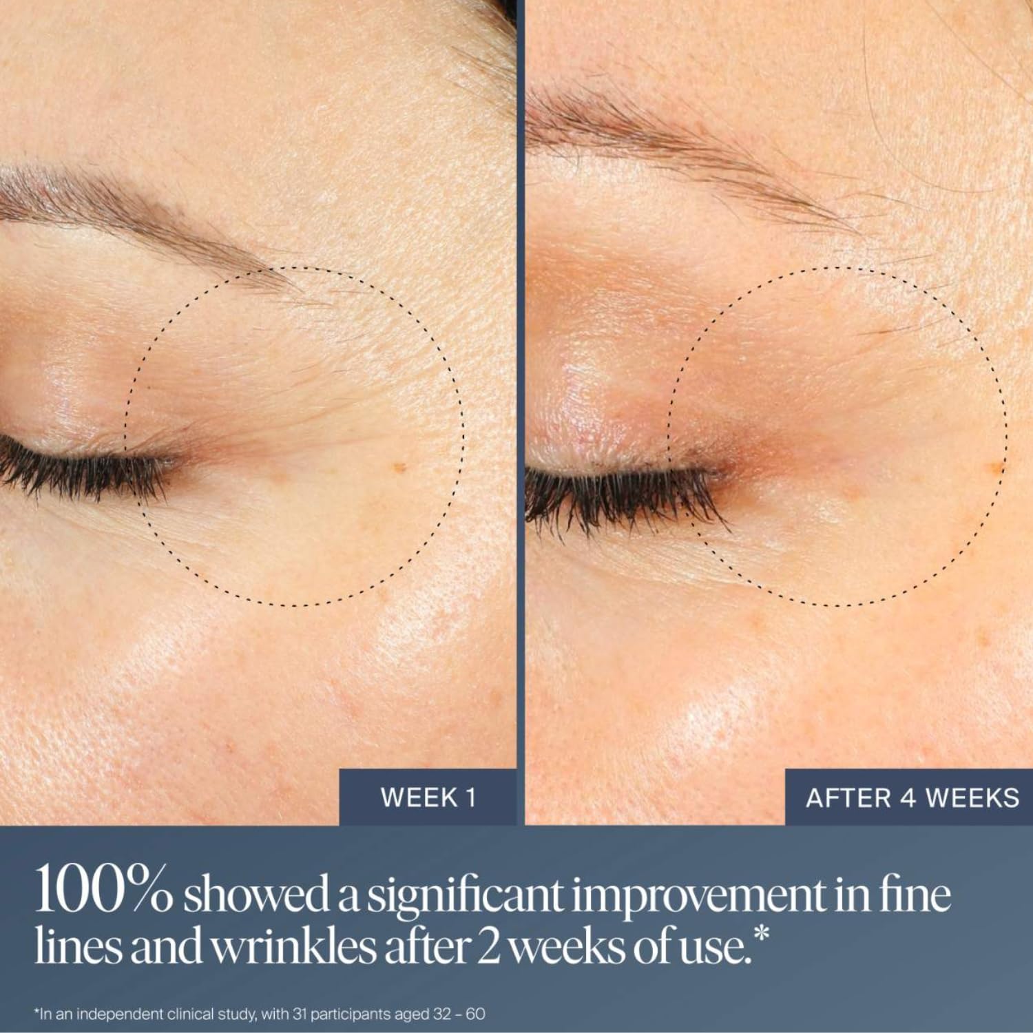 Summer Fridays Jet Lag Overnight Eye Serum - Nourishing Undereye Treatment for Dark Circles - Helps to Hydrate, Smooth, Firm & Depuff - Enriched with Glycerin to Lock in Moisture (0.5 Fl Oz) - TrustMedUSA