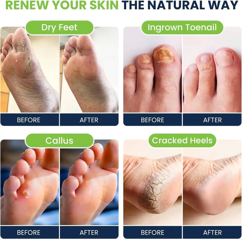 Tea Tree Oil & Citrus Detox Foot Soak with Epsom Salts - All Natural Salts for Post Workout - TrustMedUSA