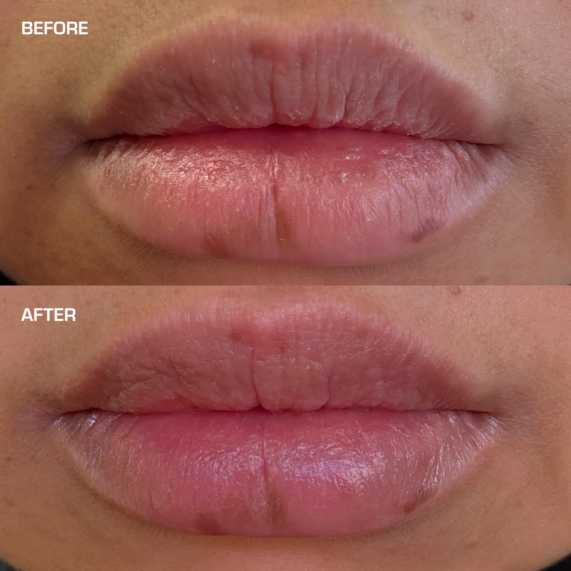 TERNS Everyday Lip Balm | Hyaluronic Acid + Baobab & Meadowfoam Oils, Algae-Powered Sirenas Complex OS, Refreshing Mint, Non-Sticky Cushion Glide, Cruelty-Free - TrustMedUSA