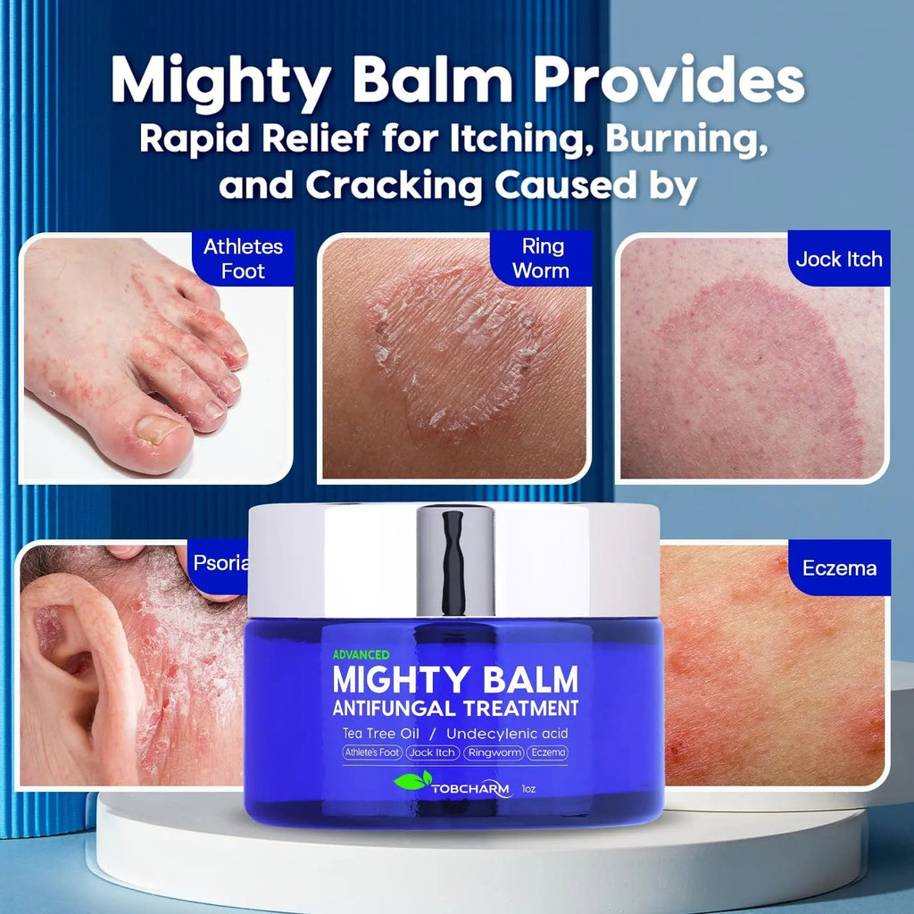 Tobcharm Antifungal Cream, Antifungal Cream for Skin, Ringworm Treatment for Humans - TrustMedUSA