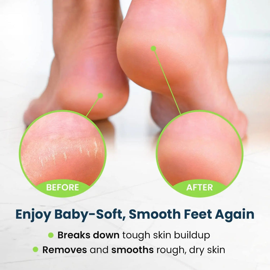 Toenail Fungus Treatment Extra Strength - Advance nail fungus treatment for fingernails - TrustMedUSA