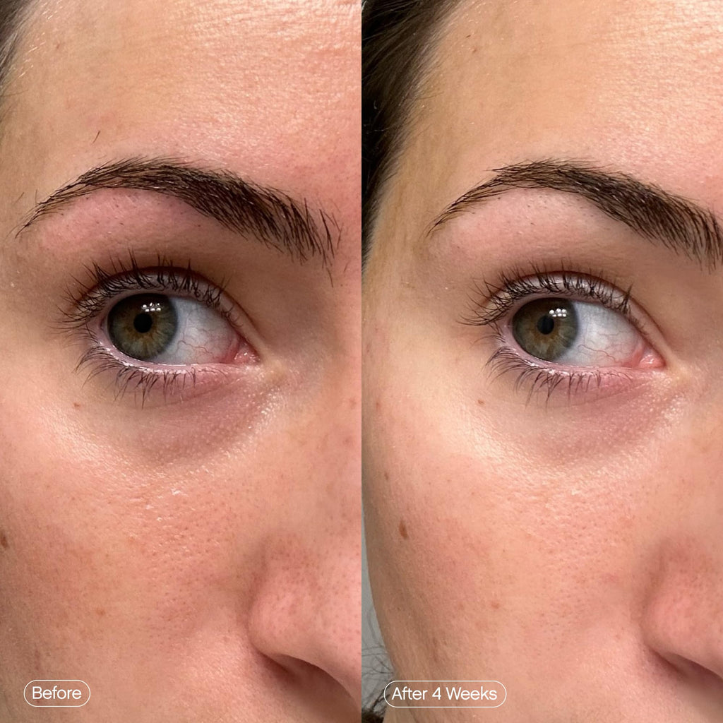 Topicals Faded Brightening Under Eye Masks | Patches to Depuff, Hydrate, Brighten and Cool | Reduce Dark Circles and Fine Lines | Contains Kojic Acid, Caffeine and Niacinamide (Set of 6) - TrustMedUSA