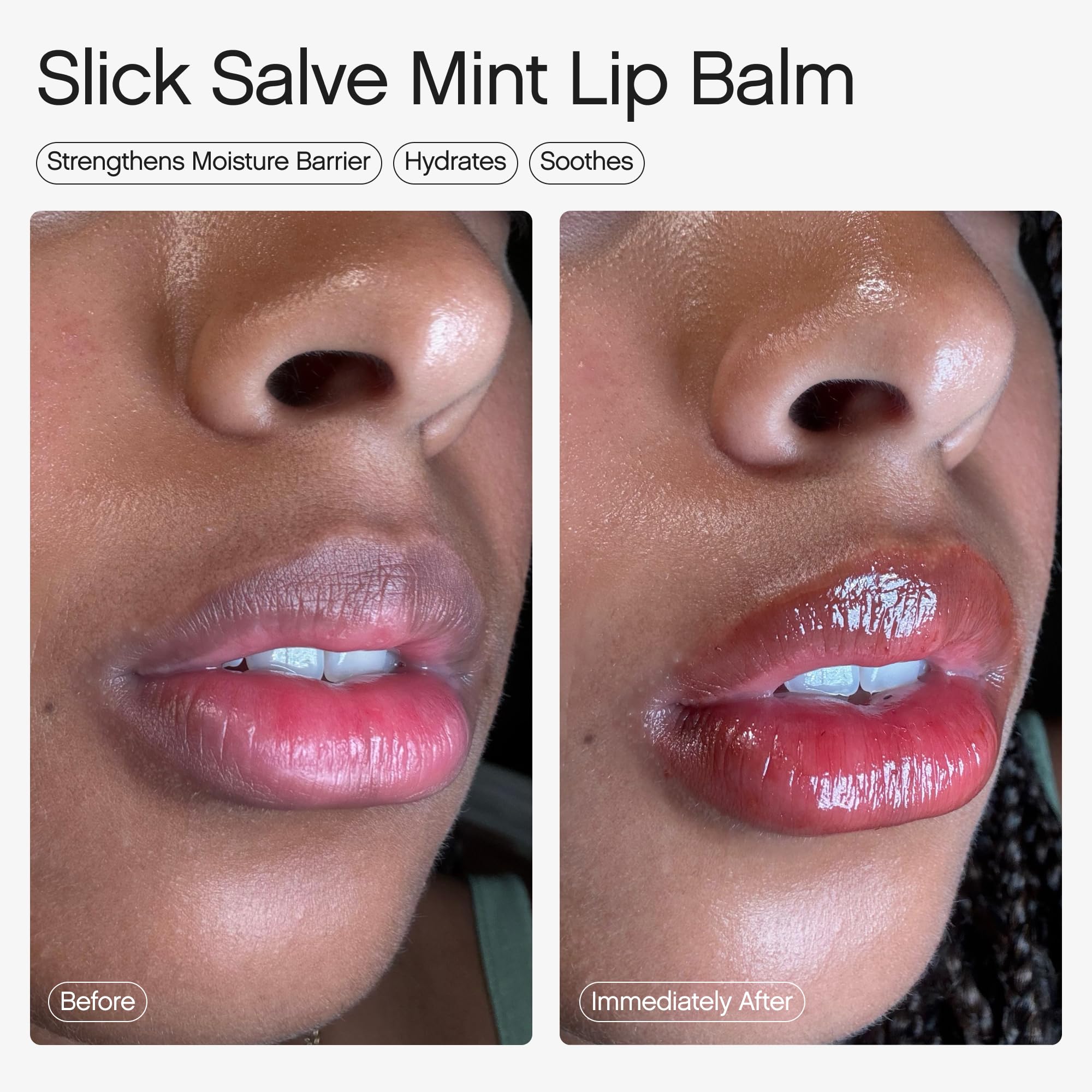 Topicals Slick Salve Mint Glossy Lip Balm | Soothes Discomfort, Strengthens Barrier and Provides Lasting Hydration & Relief | Vegan, Paraben-Free - TrustMedUSA