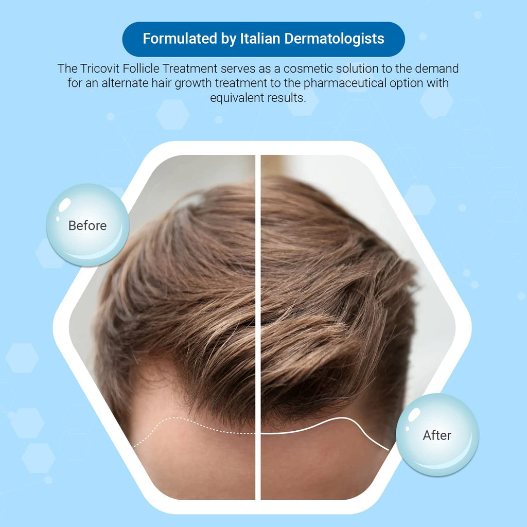 Tricovit Hair Growth Supplement - Nail & Hair Health Vitamins with Amino Acids, Minerals & Antioxidants - Dermatologist-Formulated & Gluten-Free Vitamins and Supplements for Women & Men (60 tablets) - TrustMedUSA